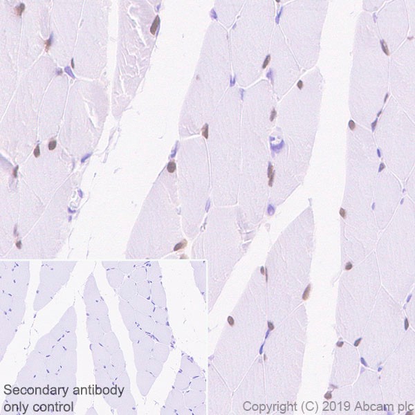 Immunohistochemistry (Formalin/PFA-fixed paraffin-embedded sections) - Anti-SIX1 antibody [1593] (AB243247), expandable thumbnail