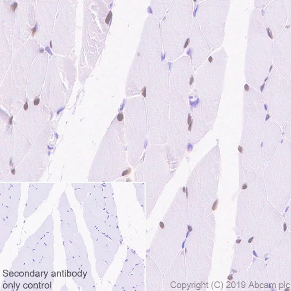 Immunohistochemistry (Formalin/PFA-fixed paraffin-embedded sections) - Anti-SIX1 antibody [1593] (AB243247)