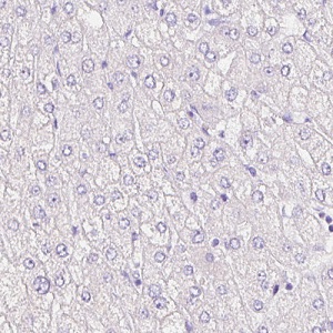 Immunohistochemistry (Formalin/PFA-fixed paraffin-embedded sections) - Anti-SIX1 antibody [CL0185] (AB236761)