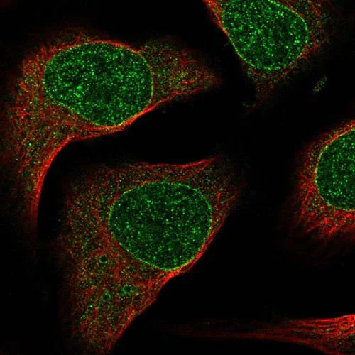 Immunocytochemistry/ Immunofluorescence - Anti-SIX2 antibody (AB220826)