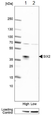 Western blot - Anti-SIX2 antibody (AB220826), expandable thumbnail