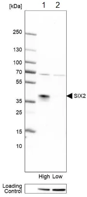 Western blot - Anti-SIX2 antibody (AB220826)