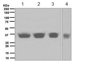 Western blot - Anti-SIX2 antibody [EPR4824] (AB111827)