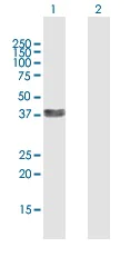 Western blot - Anti-Six3 antibody (AB172131)