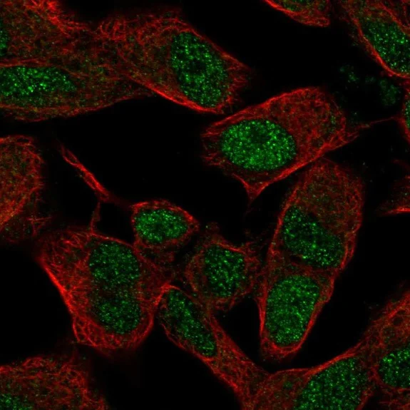 Anti-Six3 antibody (ab221750) | Abcam