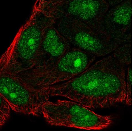 Immunocytochemistry/ Immunofluorescence - Anti-SIX6OS1 antibody (AB190267)