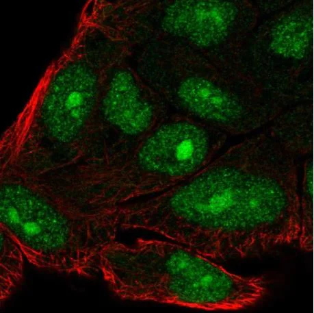 Immunocytochemistry/ Immunofluorescence - Anti-SIX6OS1 antibody (AB190267)