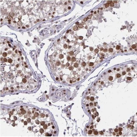 Immunohistochemistry (Formalin/PFA-fixed paraffin-embedded sections) - Anti-SIX6OS1 antibody (AB190267)
