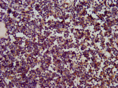 Immunohistochemistry (Formalin/PFA-fixed paraffin-embedded sections) - Anti-SKA1 antibody (AB238716)