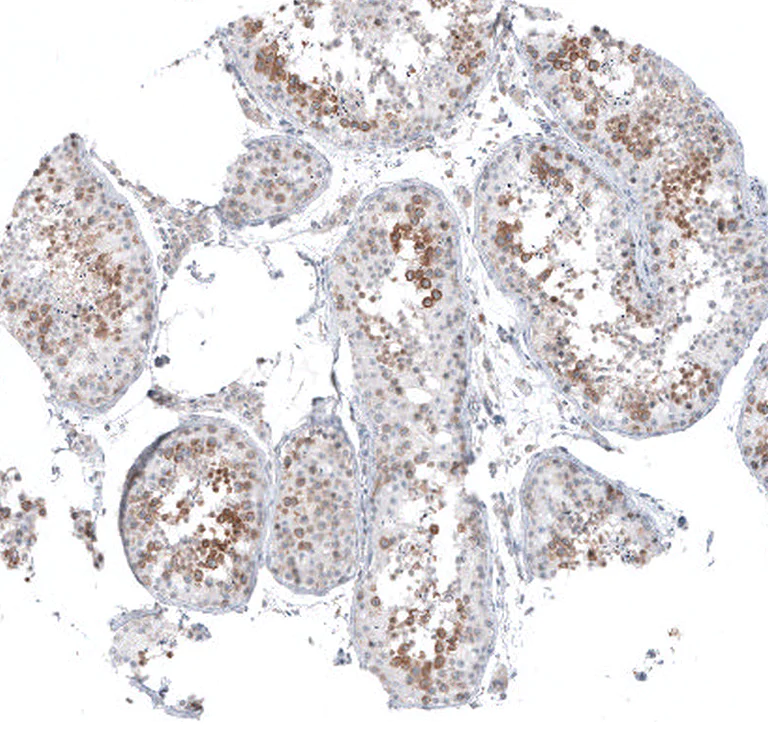 Immunohistochemistry (Formalin/PFA-fixed paraffin-embedded sections) - Anti-SKAP antibody (AB122769)