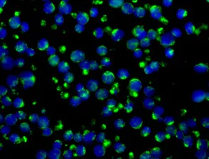 Immunocytochemistry/ Immunofluorescence - Anti-SKAP55 antibody [EPR11360] - BSA and Azide free (AB249562)
