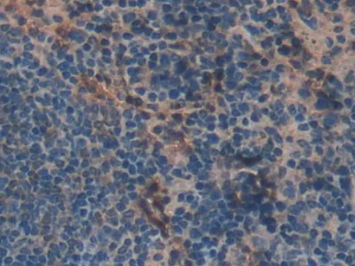 Immunohistochemistry (Formalin/PFA-fixed paraffin-embedded sections) - Anti-Skeletrophin / Mib2 antibody (AB233068)