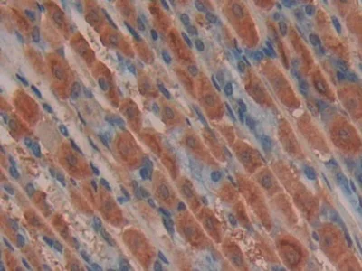 Immunohistochemistry (Formalin/PFA-fixed paraffin-embedded sections) - Anti-Skeletrophin / Mib2 antibody (AB233068)