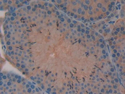 Immunohistochemistry (Formalin/PFA-fixed paraffin-embedded sections) - Anti-Skeletrophin / Mib2 antibody (AB233068)