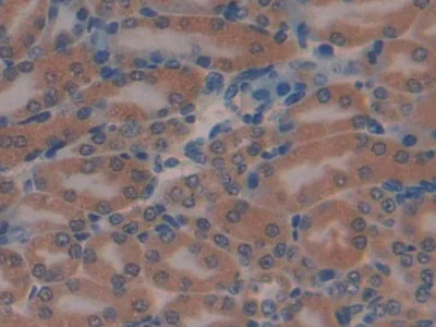 Immunohistochemistry (Formalin/PFA-fixed paraffin-embedded sections) - Anti-Skeletrophin / Mib2 antibody (AB233068)