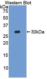Western blot - Anti-Skeletrophin / Mib2 antibody (AB233068)