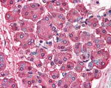 Immunohistochemistry (Formalin/PFA-fixed paraffin-embedded sections) - Anti-SKI antibody (AB115553)