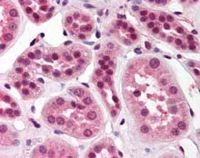 Immunohistochemistry (Formalin/PFA-fixed paraffin-embedded sections) - Anti-SKI antibody (AB115553)