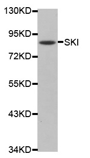 Western blot - Anti-SKI antibody (AB192520)