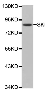 Western blot - Anti-SKI antibody (AB192520)