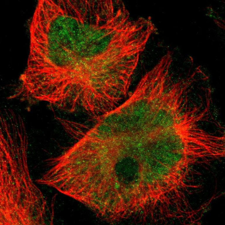 Immunocytochemistry/ Immunofluorescence - Anti-SKIL Antibody (AB327190)