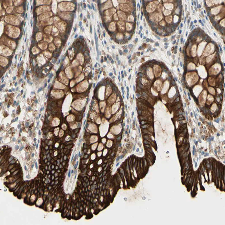 Immunohistochemistry (Formalin/PFA-fixed paraffin-embedded sections) - Anti-SKIL Antibody (AB327190)