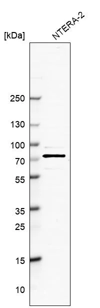 Western blot - Anti-SKIL Antibody (AB327190)