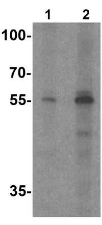 Western blot - Anti-Skn1 antibody - C-terminal (AB191840)