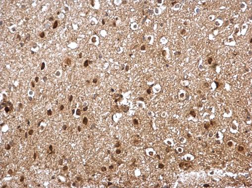 Immunohistochemistry (Formalin/PFA-fixed paraffin-embedded sections) - Anti-Skp1 antibody (AB228637)