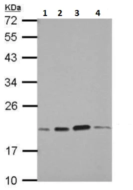 Western blot - Anti-Skp1 antibody (AB228637)