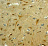 Immunohistochemistry (Formalin/PFA-fixed paraffin-embedded sections) - Anti-Skp1 antibody [EPR3303] (AB80586)