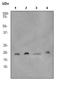 Western blot - Anti-Skp1 antibody [EPR3303] - BSA and Azide free (AB247511)