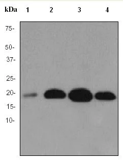Western blot - Anti-Skp1 antibody [EPR3304] - BSA and Azide free (AB247484)