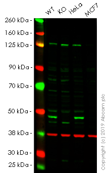 Anti-SKP2 antibody