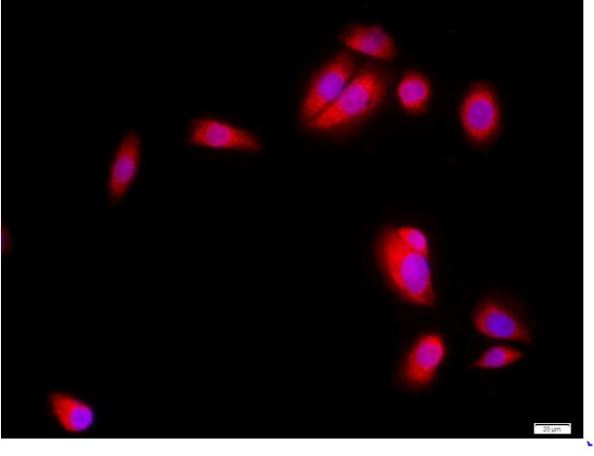 Immunocytochemistry/ Immunofluorescence - Anti-SKP2 antibody (AB216687)