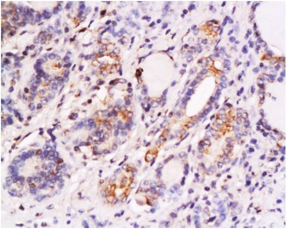 Immunohistochemistry (Formalin/PFA-fixed paraffin-embedded sections) - Anti-SKP2 antibody (AB216687)