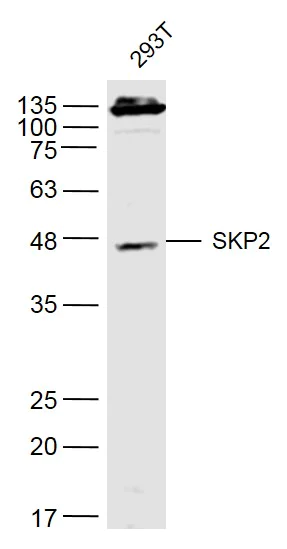 Western blot - Anti-SKP2 antibody (AB216687)
