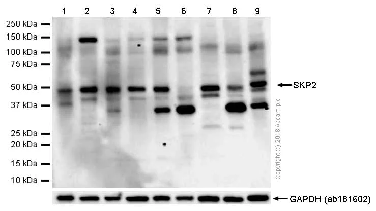 Western blot - Anti-SKP2 antibody [EPR3305(2)] (AB183039)