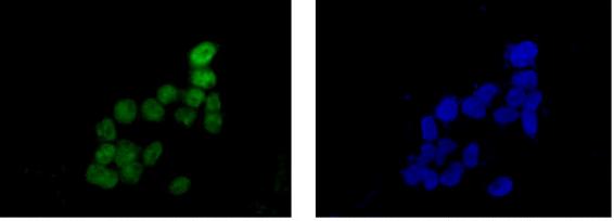 Immunocytochemistry/ Immunofluorescence - Anti-SKP2 antibody [EPR3305(2)] - BSA and Azide free (AB240263), expandable thumbnail