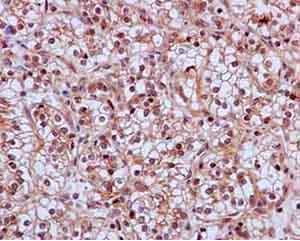 Immunohistochemistry (Formalin/PFA-fixed paraffin-embedded sections) - Anti-SKP2 antibody [EPR3305(2)] - BSA and Azide free (AB240263), expandable thumbnail