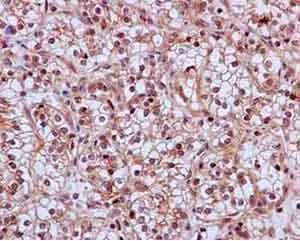 Immunohistochemistry (Formalin/PFA-fixed paraffin-embedded sections) - Anti-SKP2 antibody [EPR3305(2)] - BSA and Azide free (AB240263)