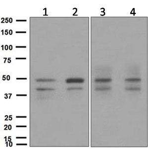 Western blot - Anti-SKP2 antibody [EPR3306(2)] - BSA and Azide free (AB248010), expandable thumbnail