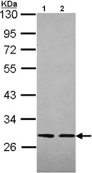 Western blot - Anti-Sla antibody (AB96620)