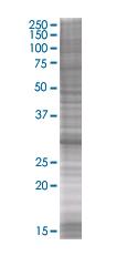 SDS-PAGE - Sla overexpression 293T lysate (whole cell) (AB94185), expandable thumbnail