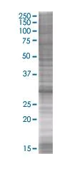 SDS-PAGE - Sla overexpression 293T lysate (whole cell) (AB94185)