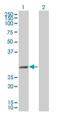Western blot - Sla overexpression 293T lysate (whole cell) (AB94185), expandable thumbnail