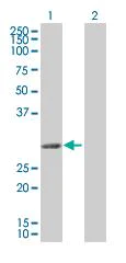 Western blot - Sla overexpression 293T lysate (whole cell) (AB94185)