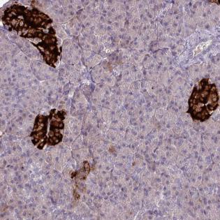 Immunohistochemistry (Formalin/PFA-fixed paraffin-embedded sections) - Anti-SLAMF6 antibody (AB188041)