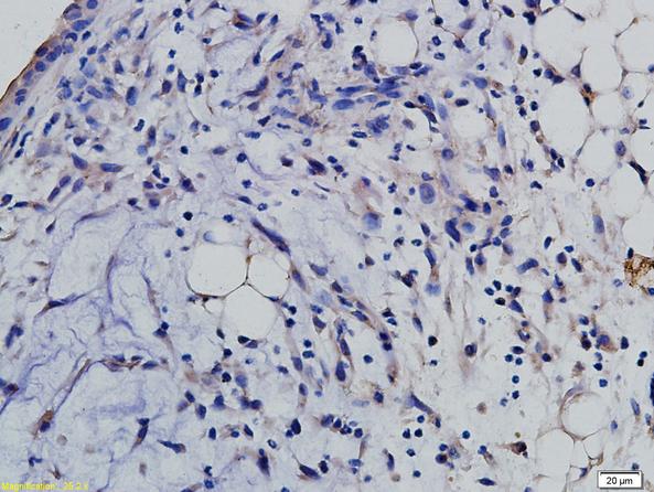 Immunohistochemistry (Formalin/PFA-fixed paraffin-embedded sections) - Anti-SLAMF6 antibody (AB213690)