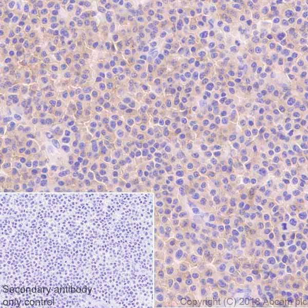 Immunohistochemistry (Formalin/PFA-fixed paraffin-embedded sections) - SLAMF7 Antibody Panel (EPR21155, CAL7) (AB252203)